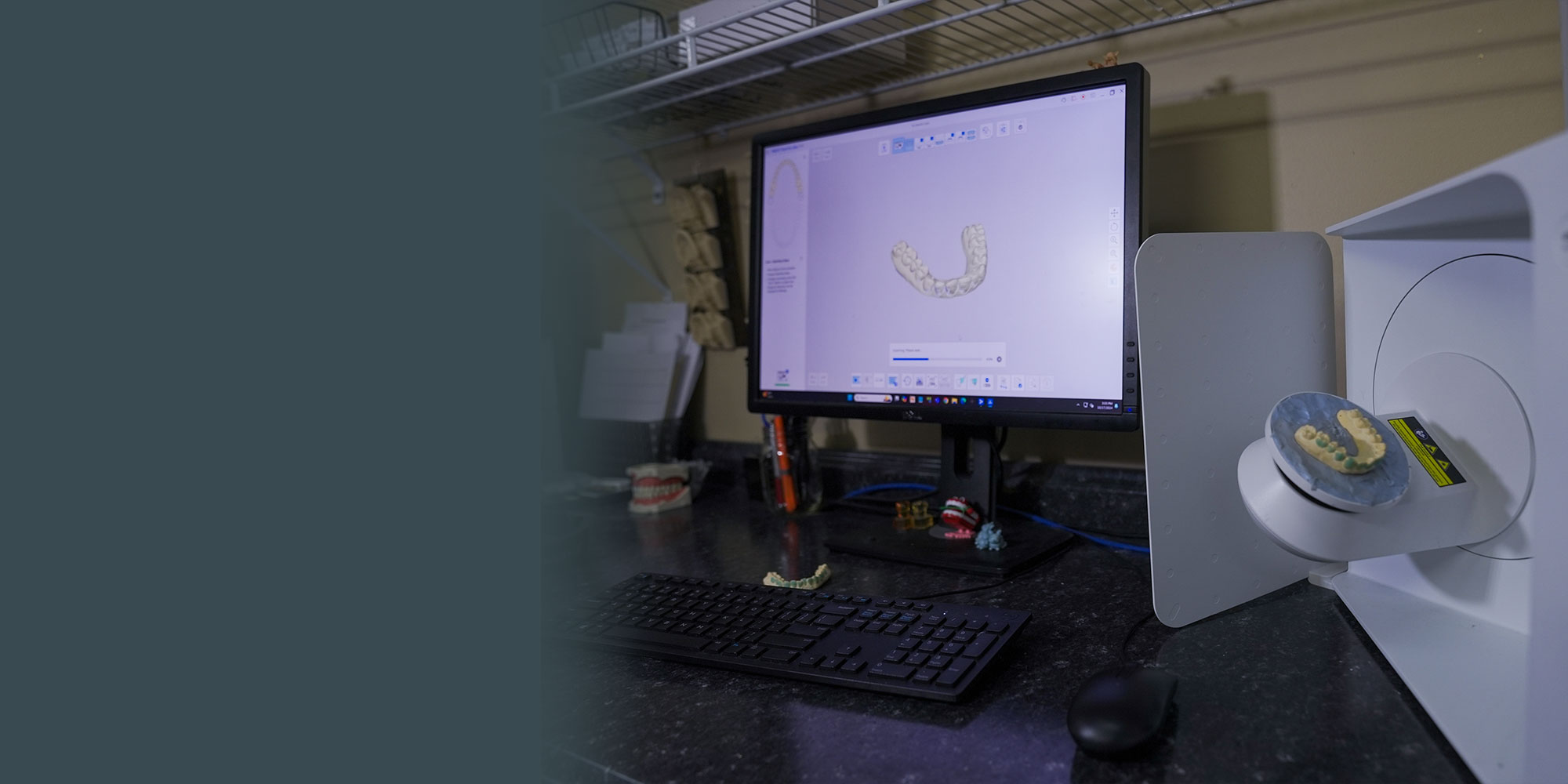 3d dental machine that makes dental implants