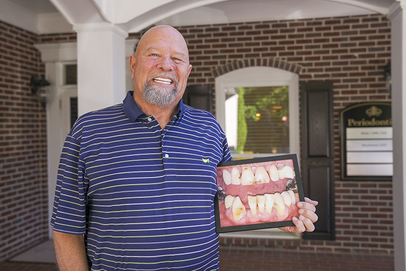 patient showing a before photo of their teeth
