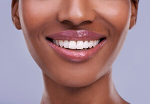 What Can you not do After Crown Lengthening?