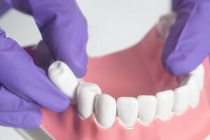 What is Tooth extraction