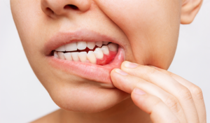 What Exactly Does a Periodontist Do?