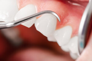 Guidelines For Keeping Your Gums Healthy