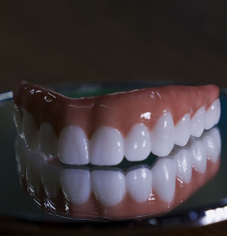 All-on-4® Full Arch Dental Implants
